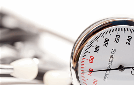 Home GP service for hypertension in Manilva